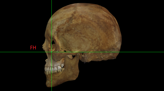 Modelo 3D de un cráneo posicionado en el Plano de Frankfurt