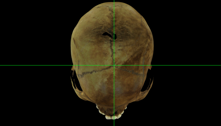 Bregma en el modelo 3D de un cráneo en Norma Verticalis