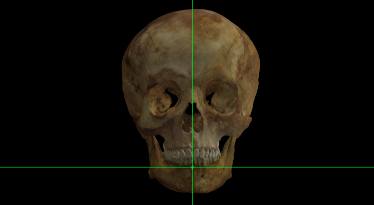 Infradentale en el modelo 3D de un cráneo en Norma Frontalis