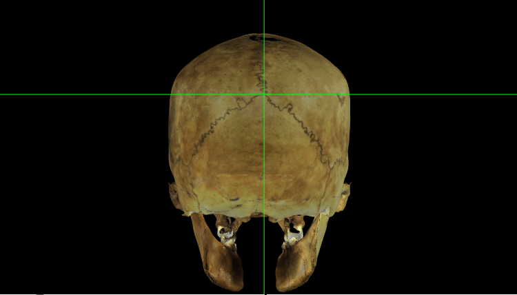 Lamda en el modelo 3D de un cráneo en Norma Occipitalis