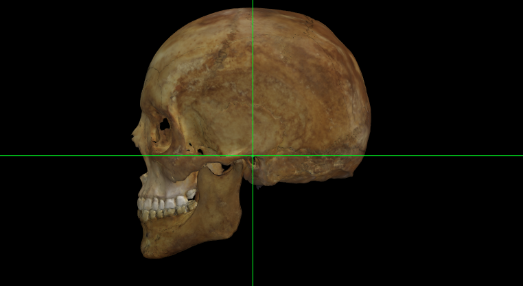 Porion (izquierdo) en un modelo 3D del cráneo en Norma Lateralis