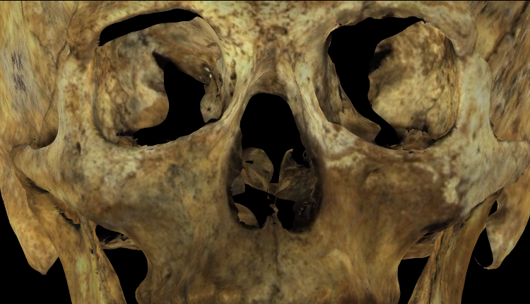Magnified image showing the maxillar bone on a skull 3D model with low definition of the zygomaxillary sutures in Norma Frontalis