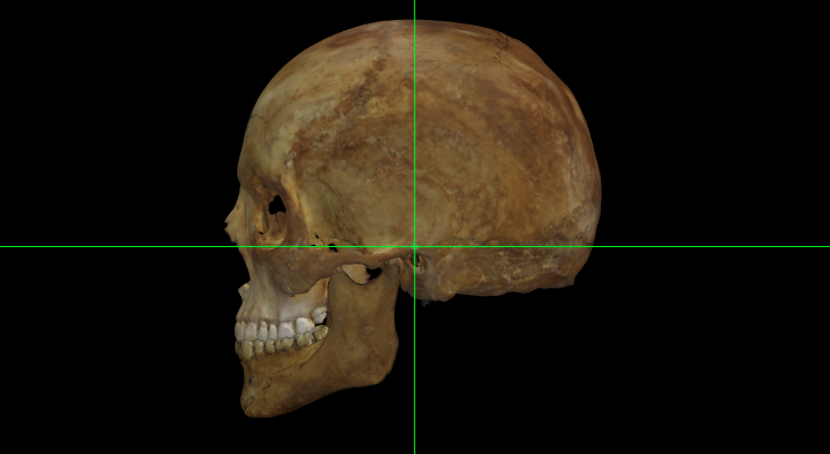 Auriculare (izquierdo) en el modelo 3D de un cráneo en Norma Lateralis